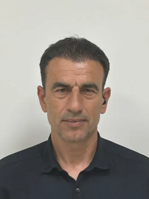 Saç ekimi sonrası, vaka 3