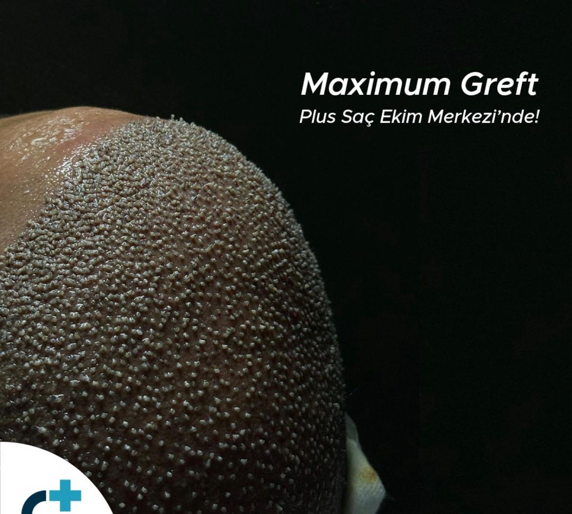 whatsapp image 2026 02 23 at 13.56.17 (4)